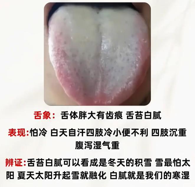 怕冷乏力、腰酸盗汗，四种舌头看出身体亏虚类型