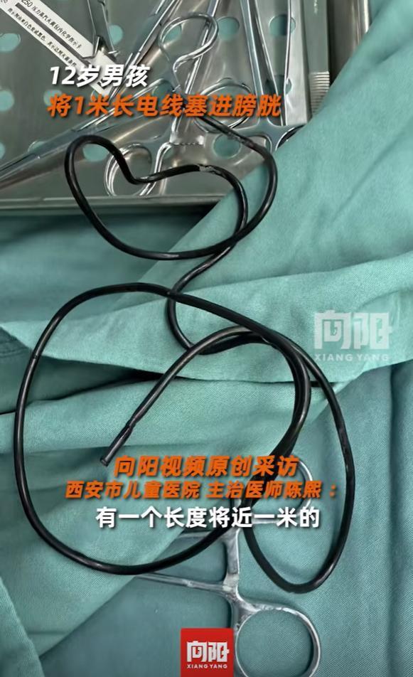 陕西西安，男孩不小心把1米多的电线塞入膀胱内，但他不敢告诉父母，3天后出现血尿，