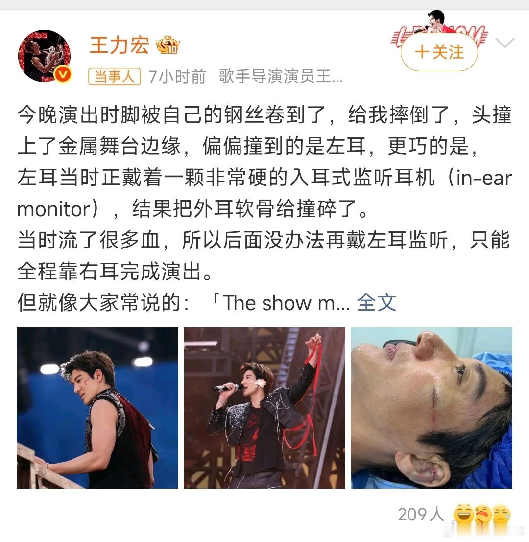 王力宏缝了39针王力宏这一摔，听得人骨头缝都痛，舞台上震撼，舞台下全是铁疙瘩电线