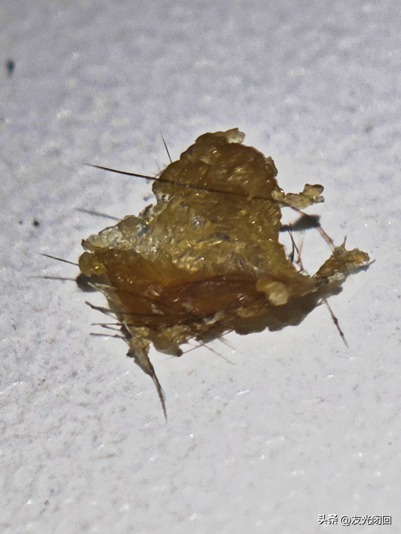 吓我一跳！
今天耳洞痒，用手指甲挖了两坨耳屎出来，顿觉耳朵通透，清爽了！看着桌上