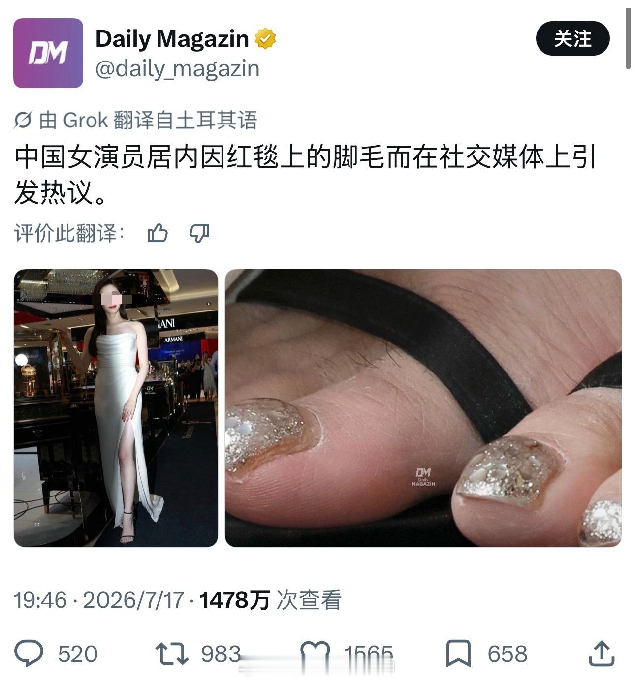 到底是谁热议了？神经啊……土耳其人海外新鲜事热点现场