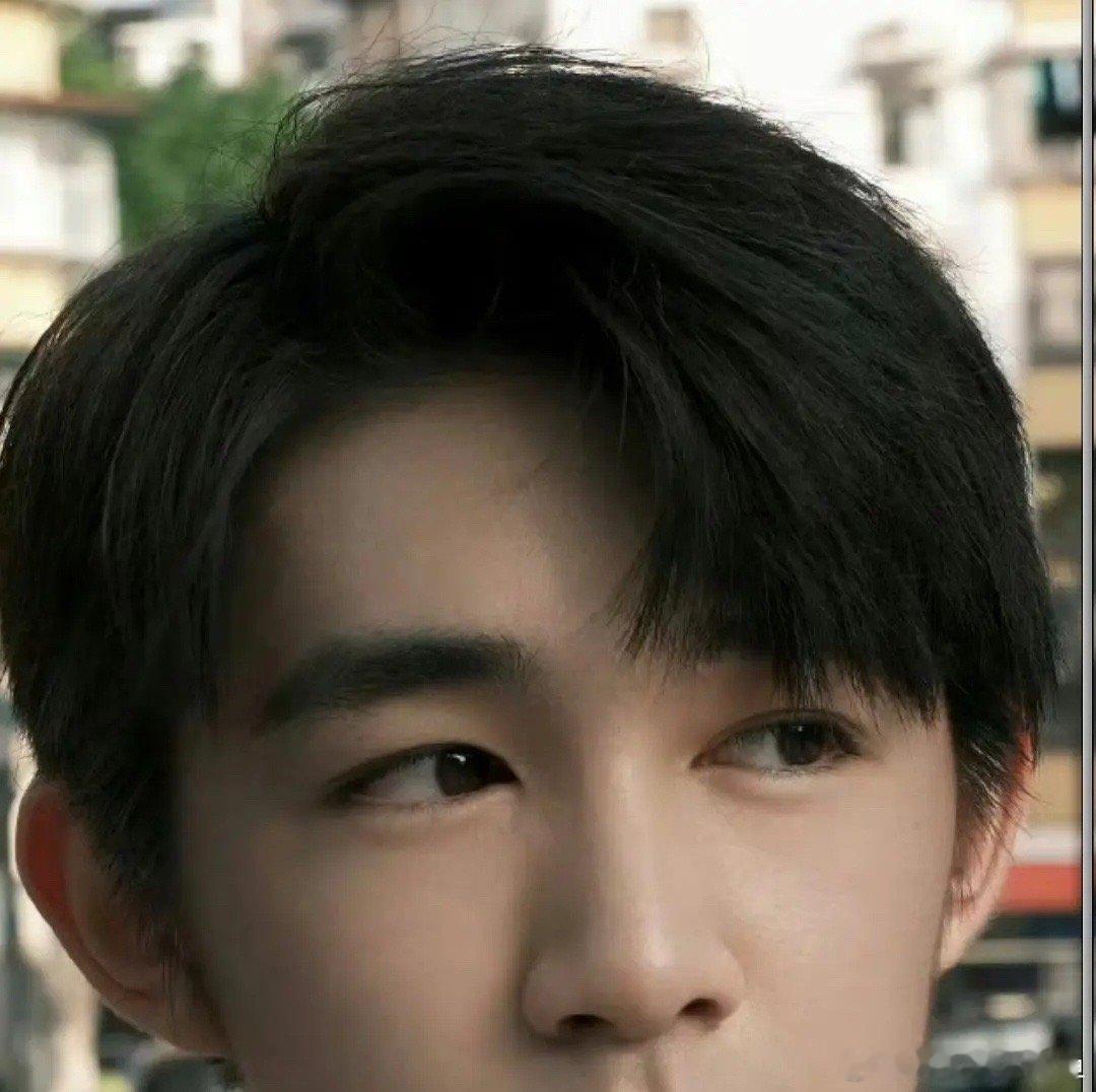 荣梓杉眼睛咋了？拉了还是贴了？ ​​​