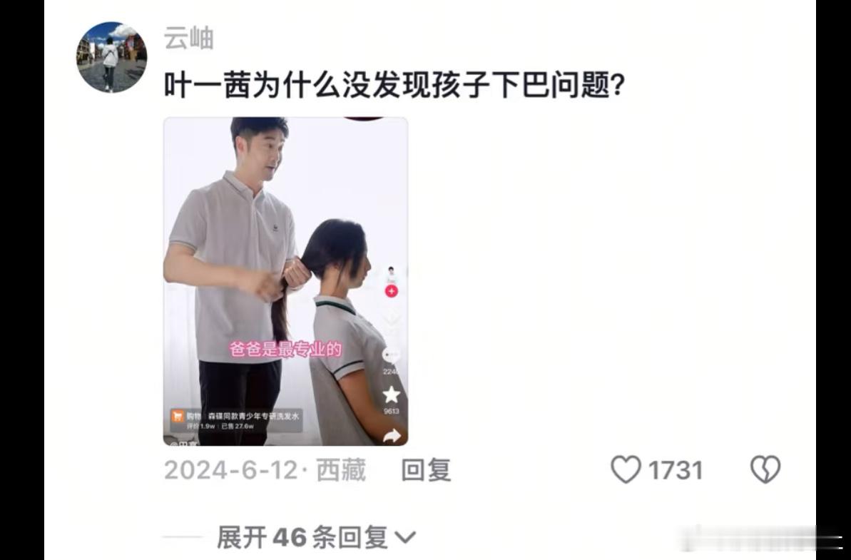 田亮女儿进行下巴后缩矫正 评论区发现很早之前就有网友提醒了叶一茜森蝶下巴有问题，