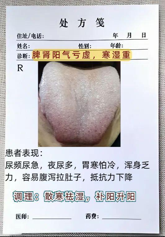 今天继续分析舌象，留下你的舌头照片，我来辨证分析！
#中医##健康科普##舌诊#