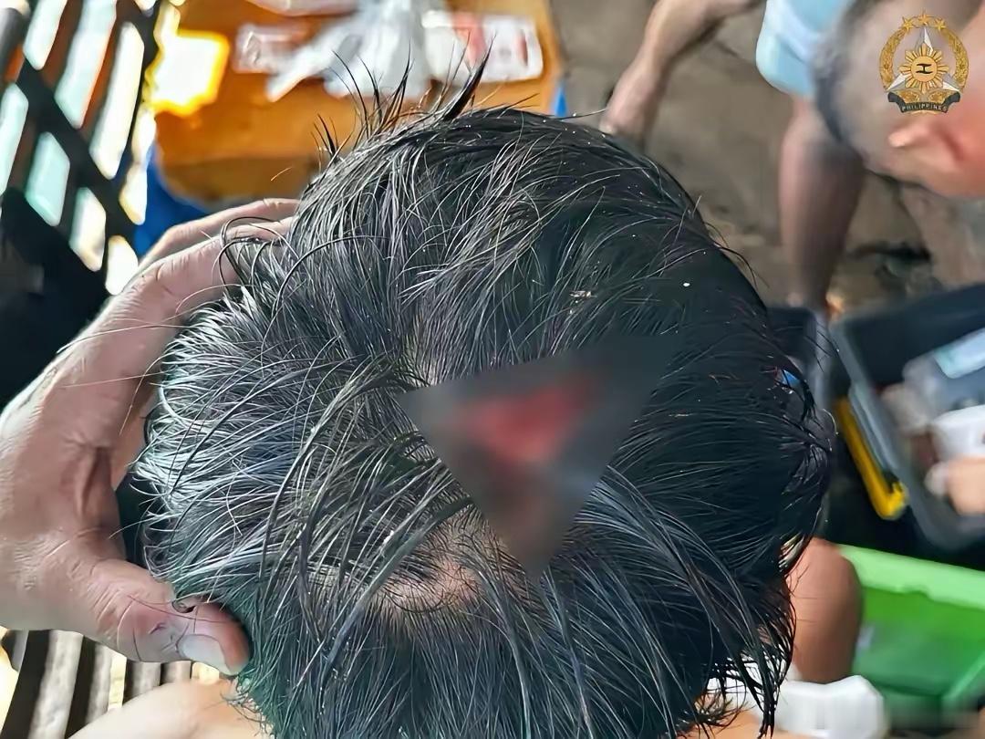 被我海警直接开了瓢的就是这个猴崽子，在这一次冲突，他非常嚣张，最积极，冲在最前面