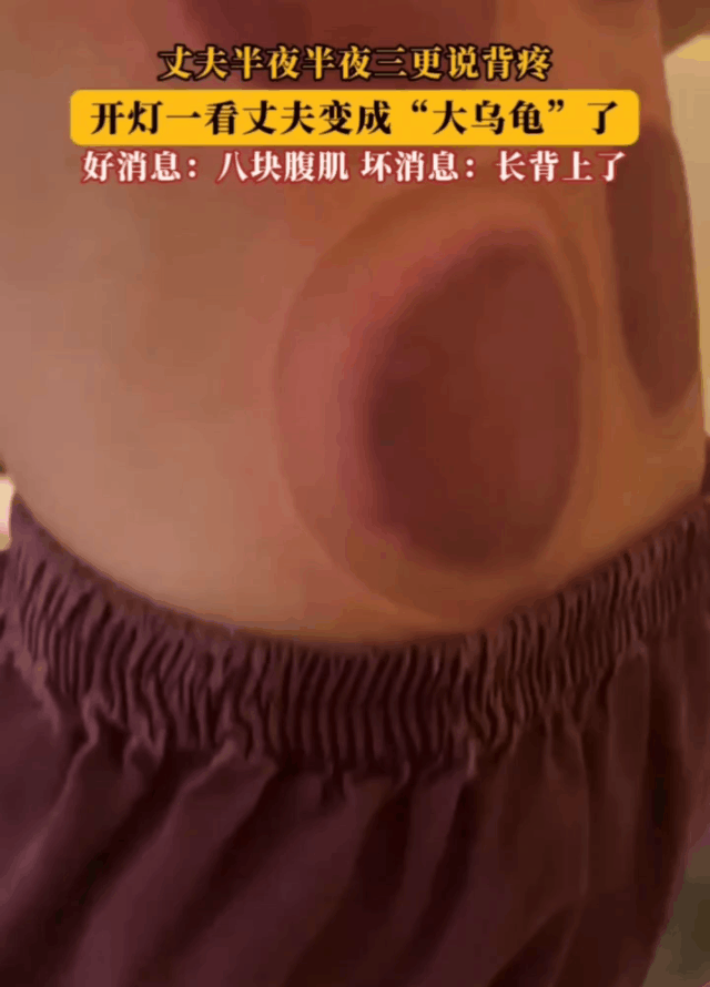 老公三更半夜说背疼，开灯一看，丈夫变成大乌龟了！
