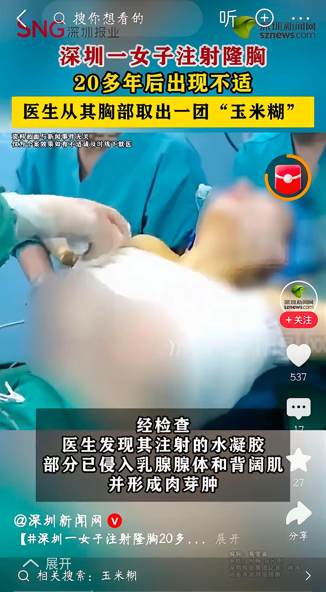 刷到一条新闻，看得我心里直发毛。6月25号，深圳一个王女士，因为胸部持续不舒服去
