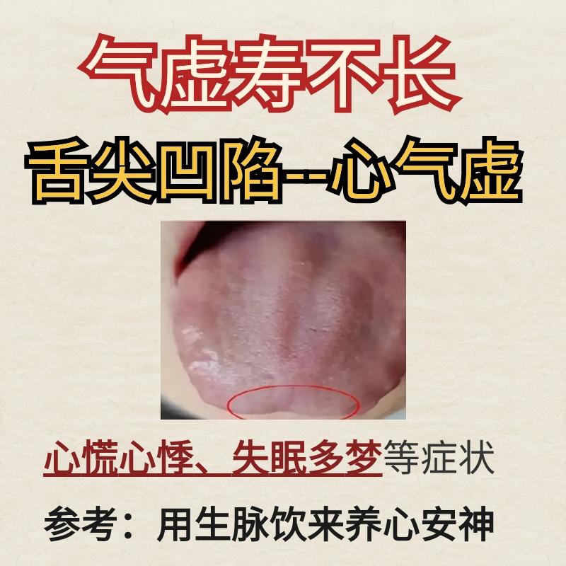 气虚寿不长，自测从舌根到舌尖，看看你的舌凹陷是哪里出问题了？#中医健康##舌象分