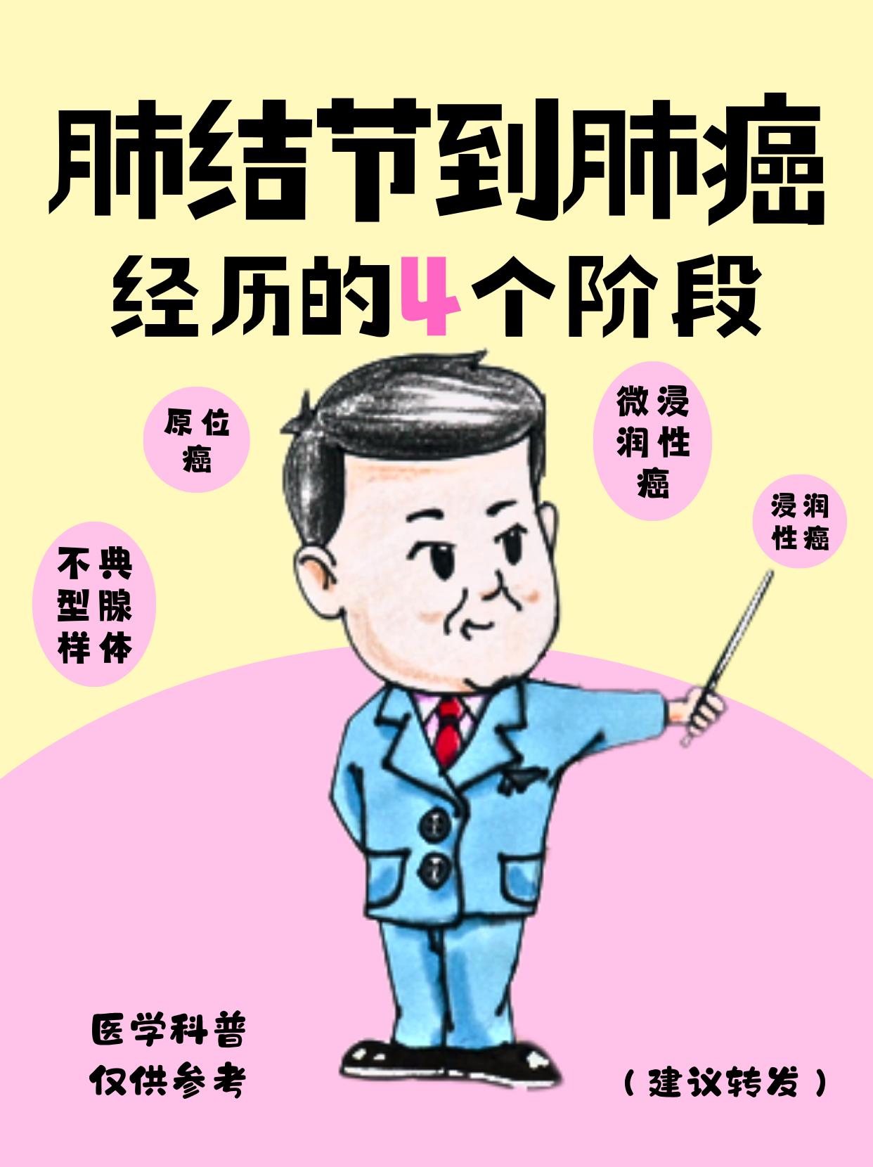 肺结节到肺癌经历的4个阶段。