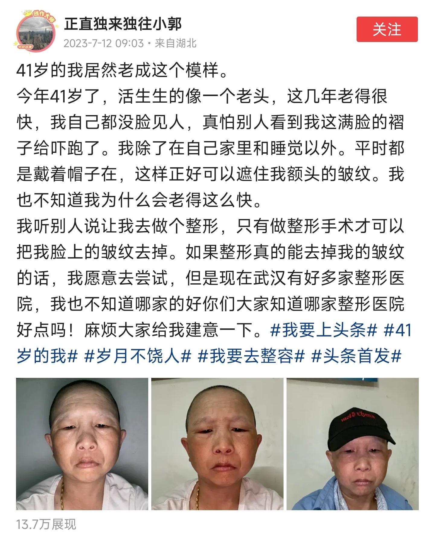 这位老哥才41岁，居然老成了这个样子？[吃惊][吃惊]有大夫嘛？知道这是什么原因