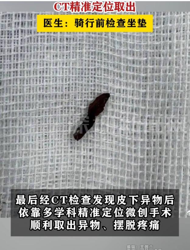 深圳62岁阿姨外阴跟针扎般的剧痛折磨了整整两年，走一步疼一步，坐也不是站也不是，
