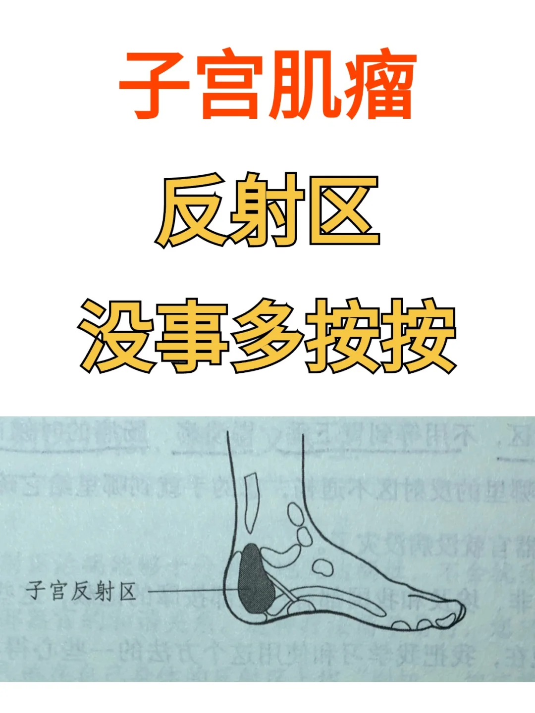 子宫肌瘤，反射区，没事可以多按按！