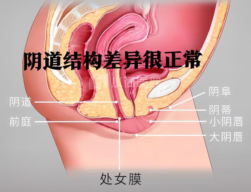 我闺蜜上周哭着给我打电话，说她看了网上那些“完美私处”的图片后，觉得自己“不正常