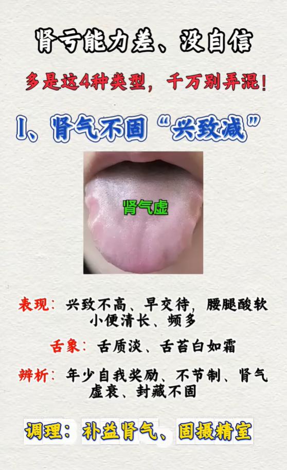 肾亏状态差不用乱调，四种舌象分清自身体质