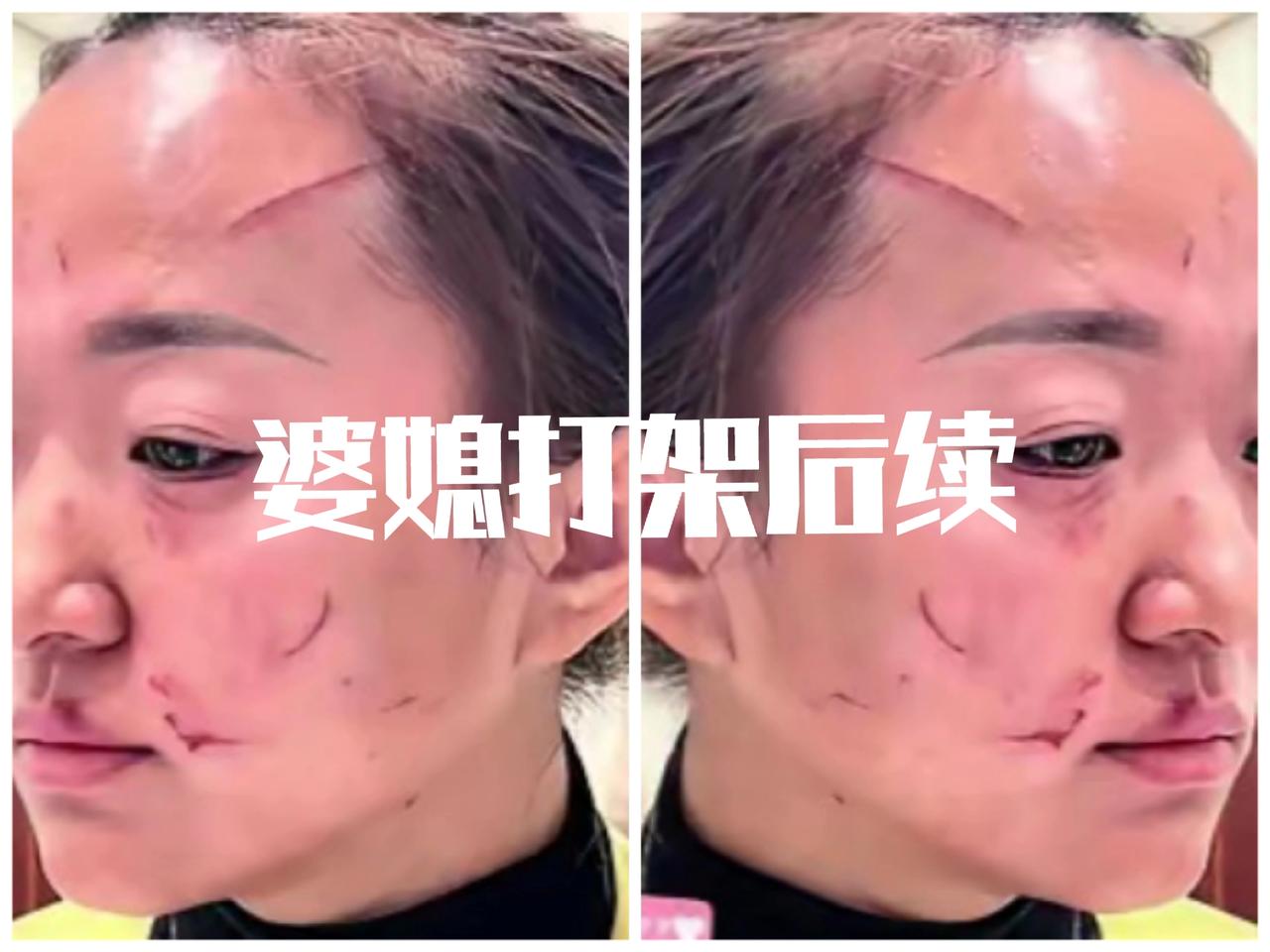 婆媳关系，想处理好，为什么就那么难呢，同样都是女人，为何总是处处刁难，针锋相对呢