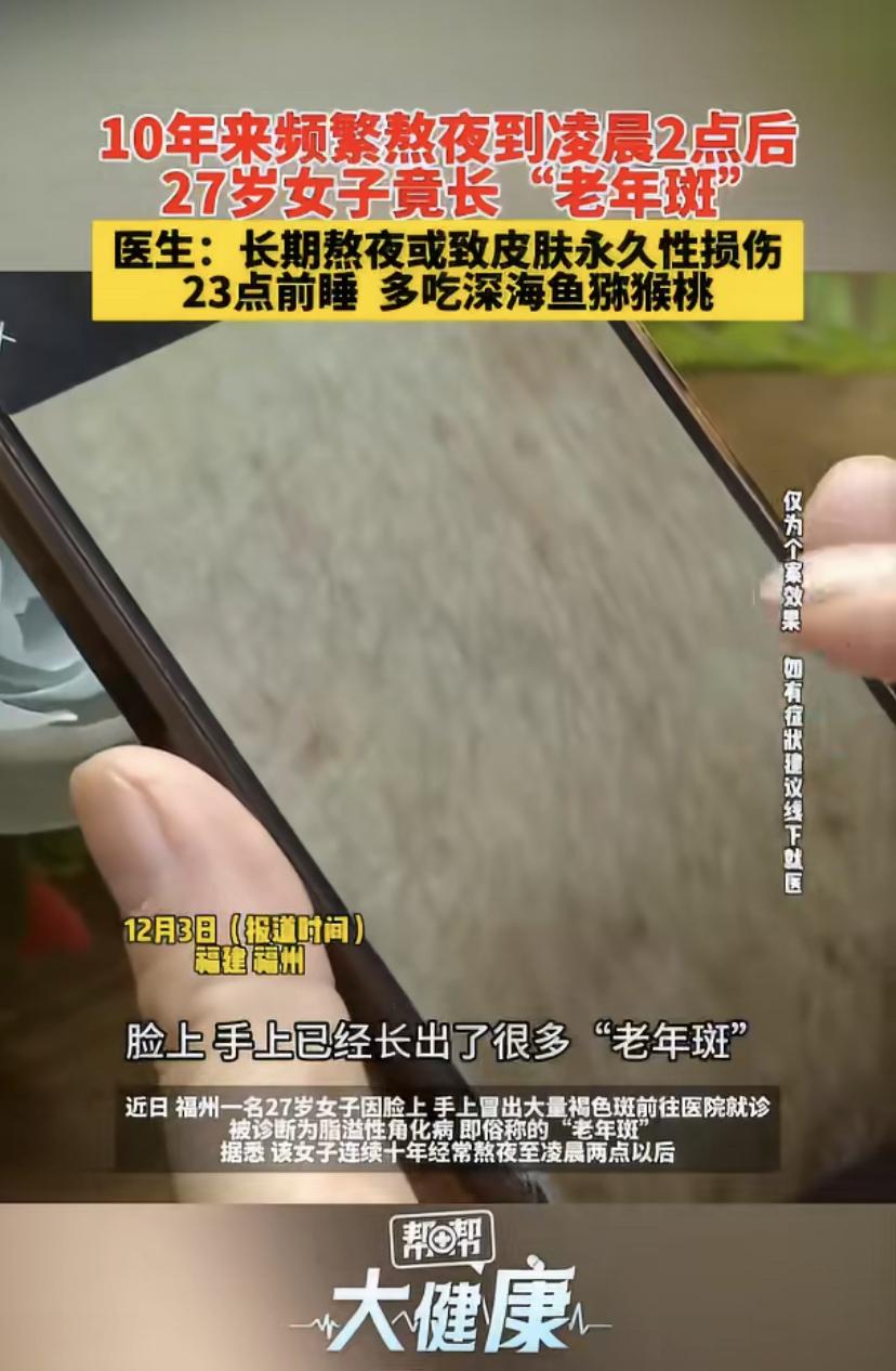 这真是给所有夜猫子敲响的一记警钟!
福州一位27岁的姑娘发现脸上、手上突然冒出许