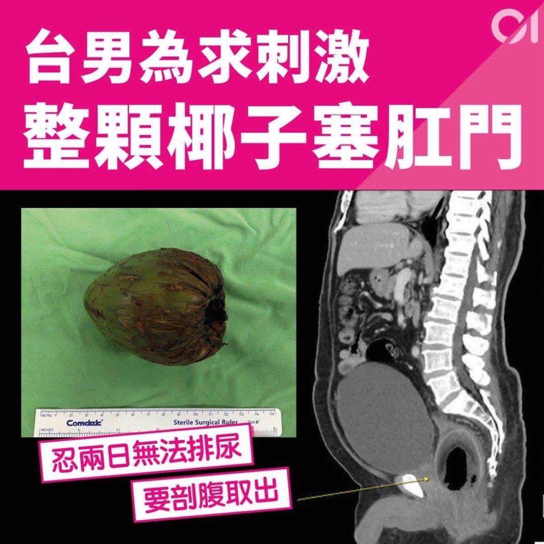 就像小米su7锁单全都说是不小心#meme# ​​​