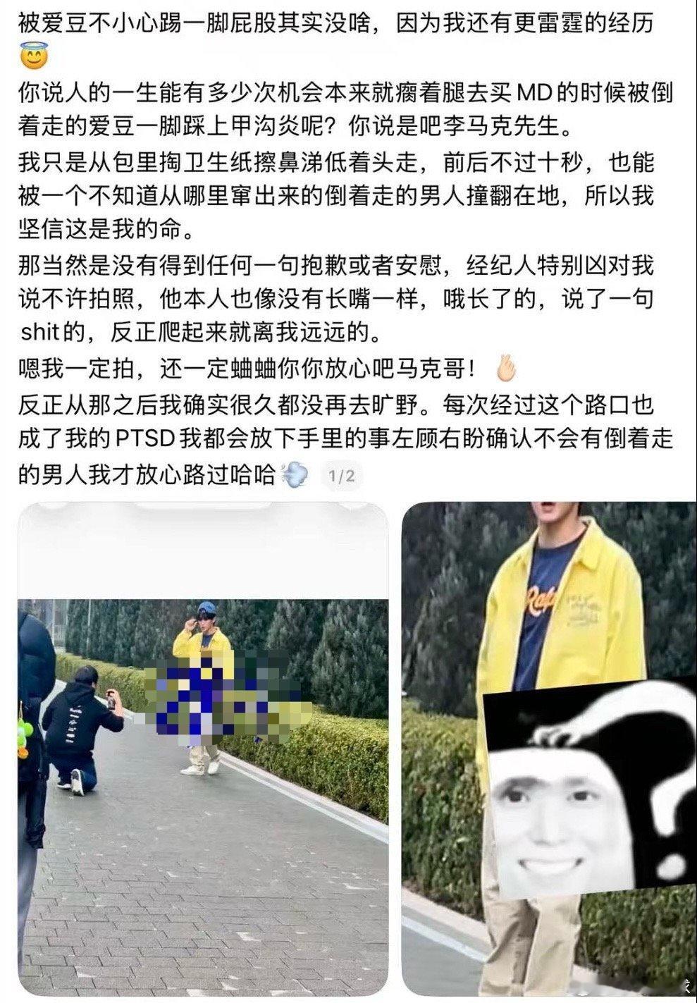 🍠 李马克超绝扁平足 走路看着点道