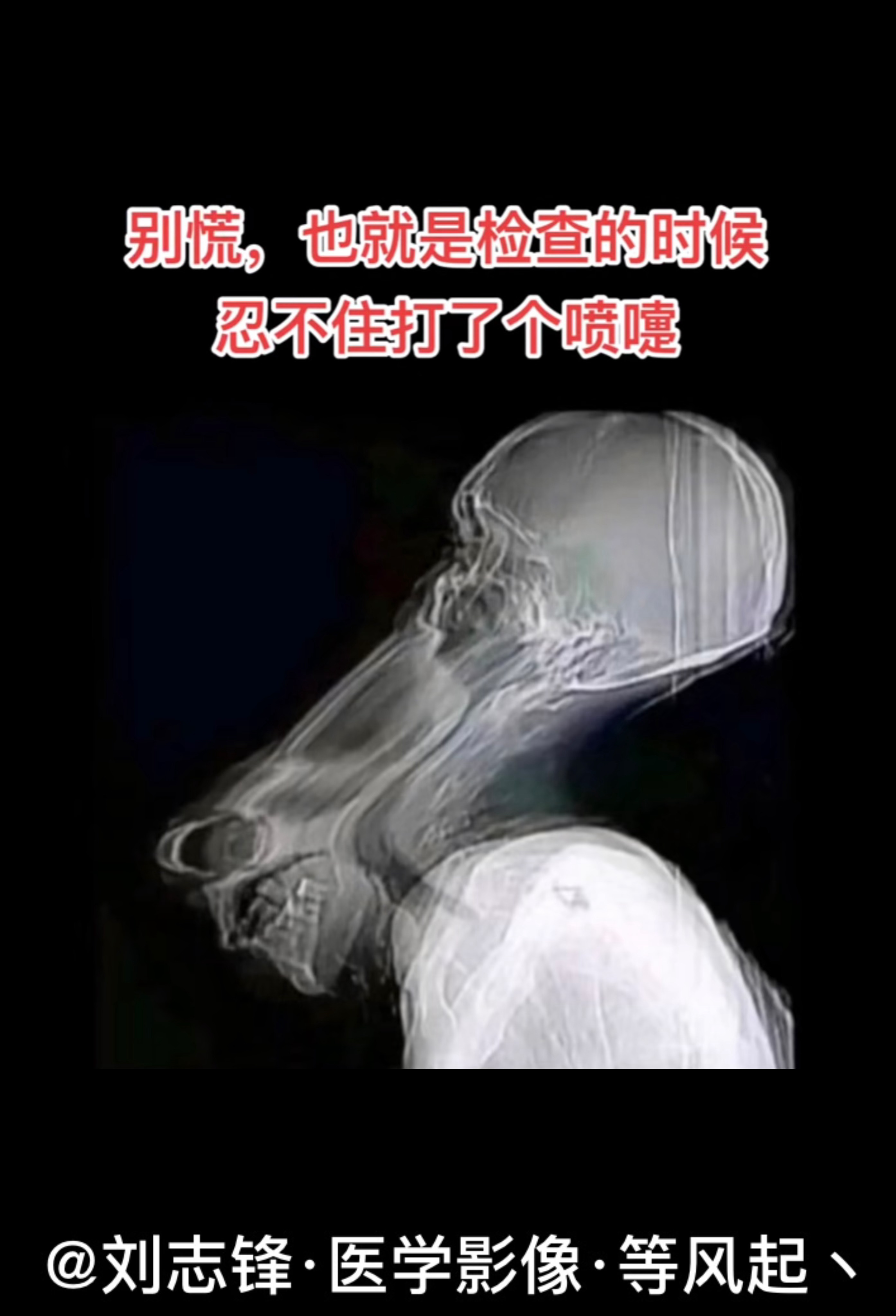 拍ct时忍不住打了个喷嚏 ​​​