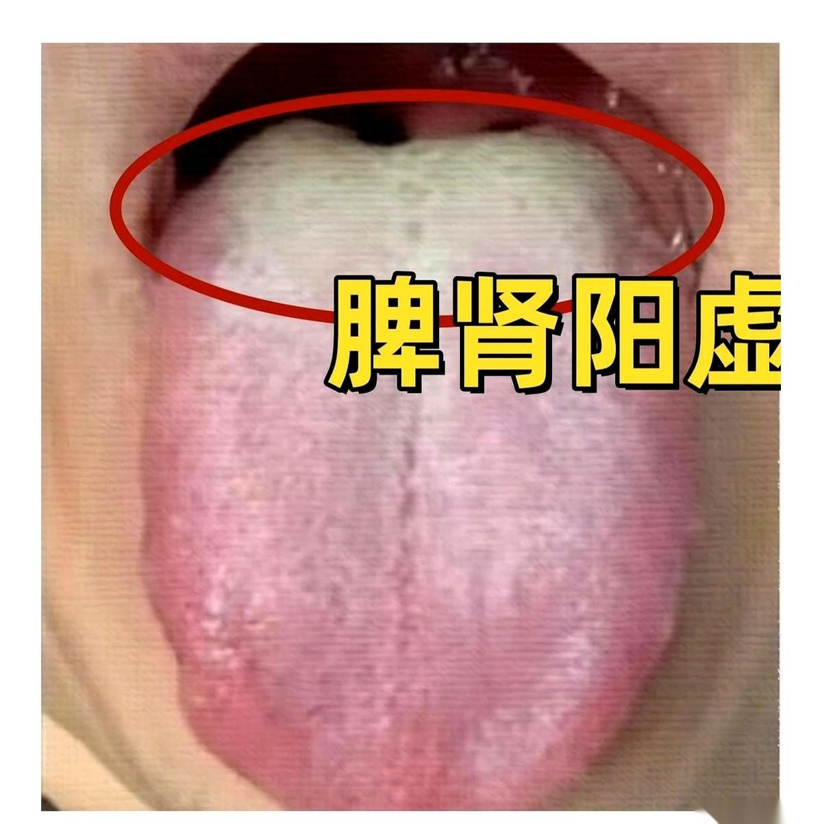 兄弟，四十来岁，感觉自己那方面不行了，第一反应是不是觉得自己肾虚了？
然后就吭哧