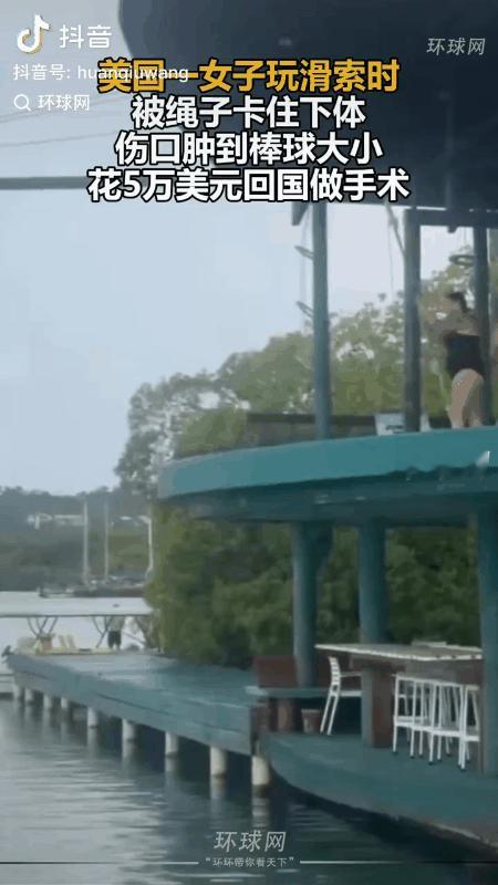 危险无处不在！

美国一女子在玩滑索（也就是跳秋千）时，不慎被绳索卡住下体，伤口