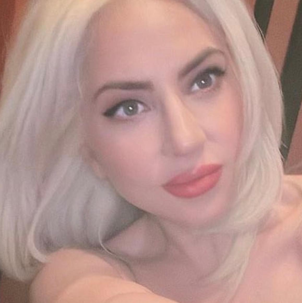 Lady Gaga 整容大变样？最新照片又变了。