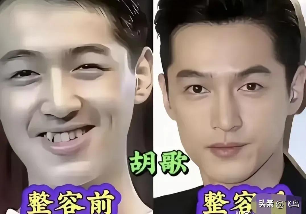 整容后的男明星，看起来确实是精致了很多哈 ！
看来不仅仅是女人爱整容，男人也爱整