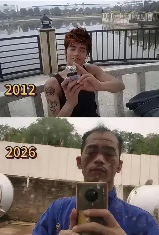 岁月真是把杀猪刀！曾经满头黑发，现在稀稀拉拉！[捂脸]