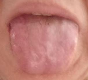 耗损过度致体虚气弱？调理不在猛补，而在找准根源






有很多朋友过往有伤精