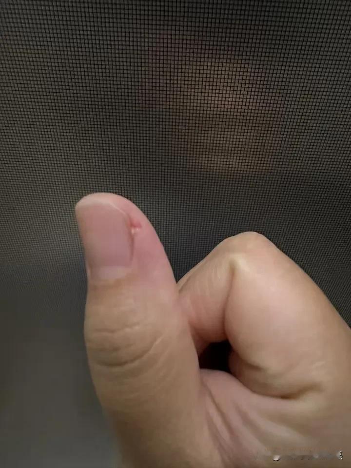 这是太干了了吗？手都裂口子了

我好像懂了，为啥有人送礼物会送护手霜了

这东西