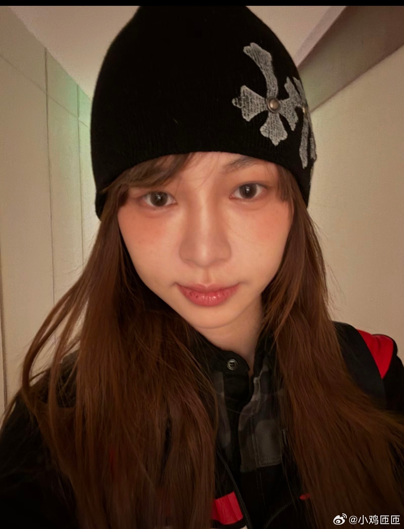 痞幼做医美了痞幼do法令纹 痞幼do了法令纹啊，脸小了一圈，变美了好多啊，完全女