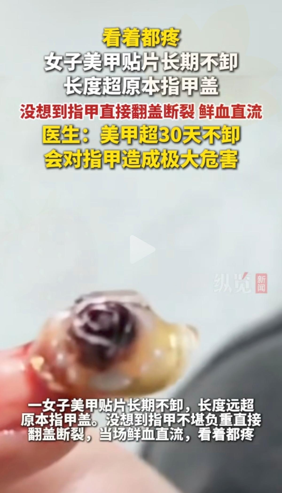 爱美真的千万别盲目！做美甲背后藏着的隐患，很多女生都根本不清楚。
 
     
