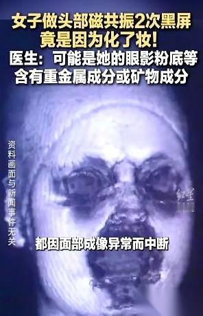 差点就成了一桩悬案。
一个姑娘，头晕得站不稳，躺进那个嗡嗡响的核磁共振大圈圈里，