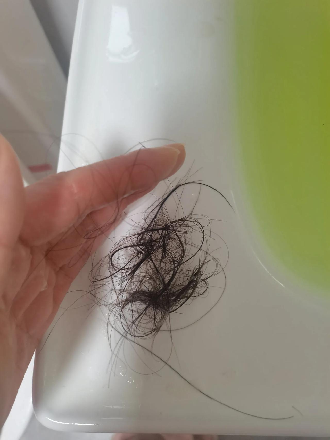 人衰老的症状之一
脱发，脱发越来越严重，家里的床上，地下，感觉哪里都是头发，每天