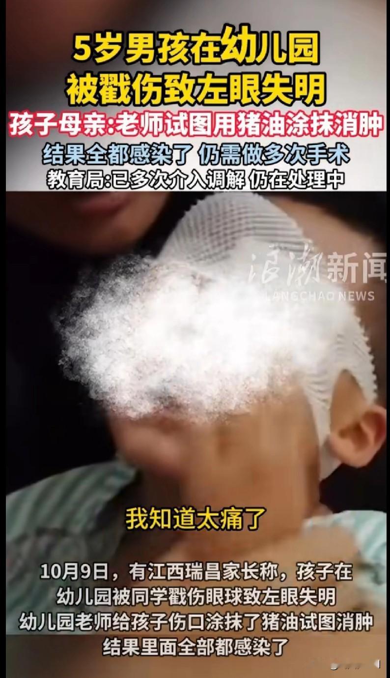 “天呐！江西瑞昌一个5岁娃在幼儿园被同学戳伤眼睛，最后左眼直接失明了！更气人的是