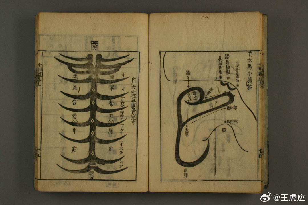 《医学至要抄》是日本江户时期综合性汉方医籍，共二卷，元禄十二年（1699）刊刻流