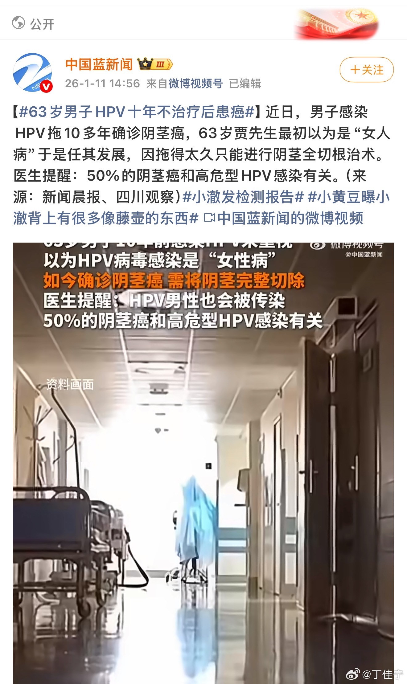 现在的大数据是真厉害，发过什么搜过什么，平台就会经常给推相关内容，之前我在微博给