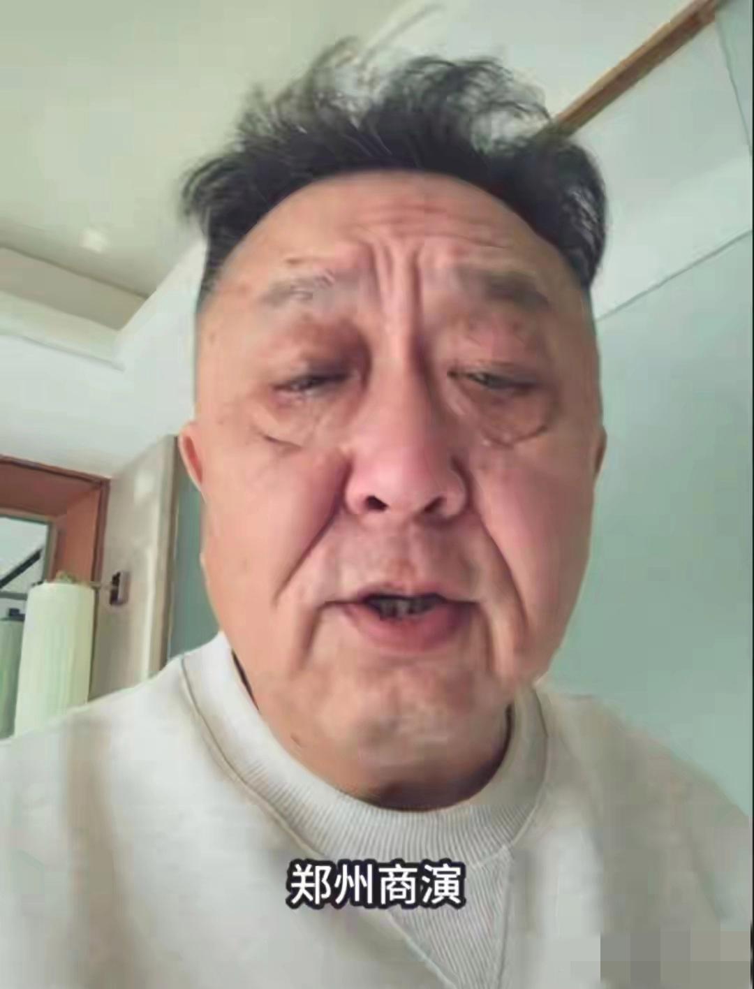 于谦近照：虽红光满面，虽只有50多岁，但额纹深刻，眼皮耷拉，眼袋粗粝，老年斑清晰