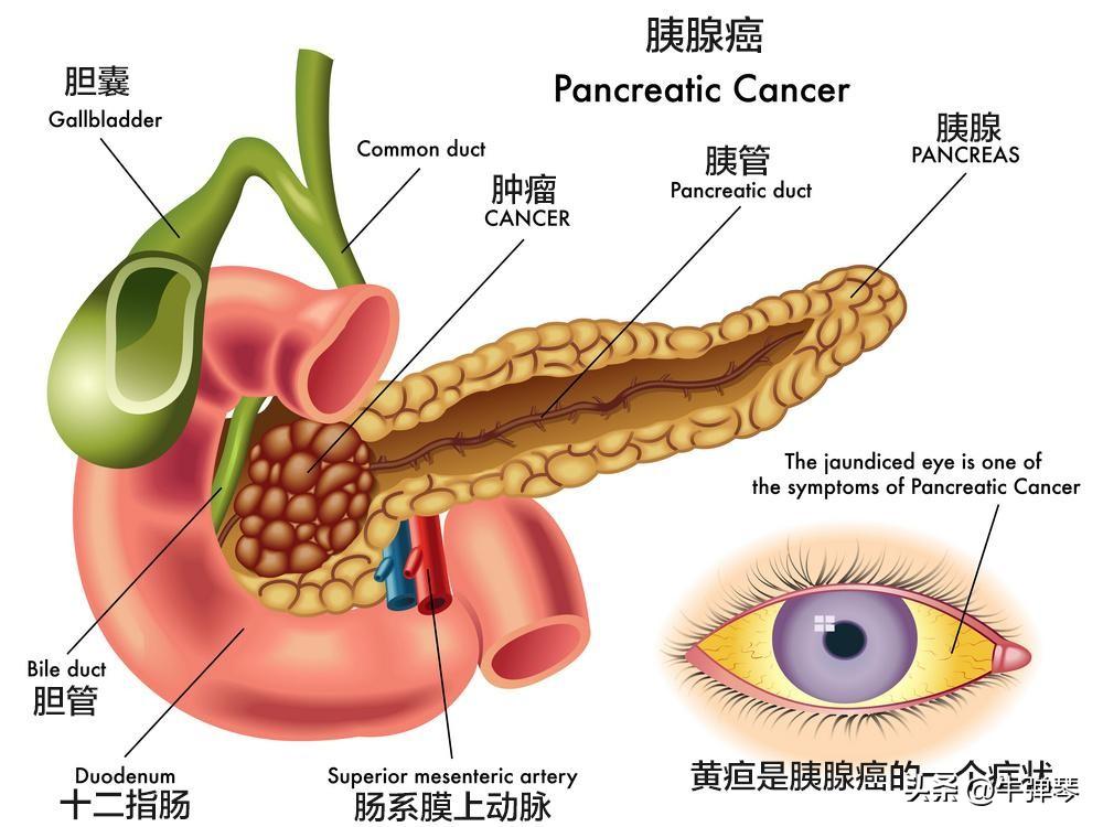 中国这项医学技术，每年据说可拯救300万人！别以为夸张，其实是有依据的。

过去