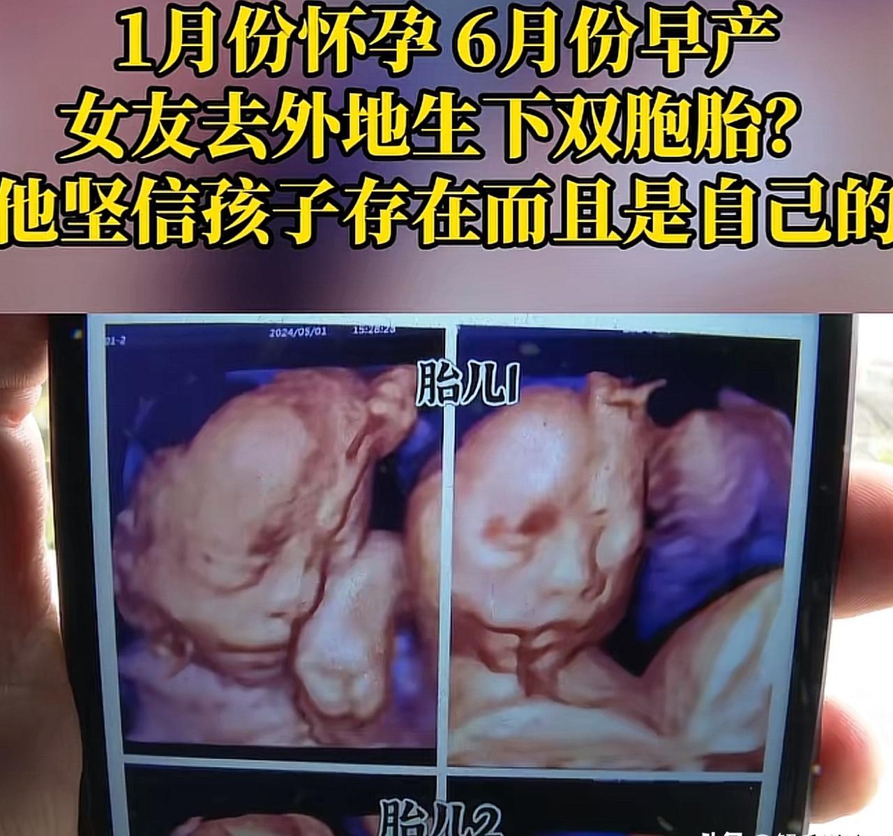 重庆30岁男子网恋怀孕遇蹊跷，

女方消失拒见子女，

四维彩超时间对不上。
