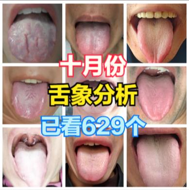 很多朋友想让杨医生，帮忙分析舌象，这当然是可以的啦！
只要你发，马上分析！

需
