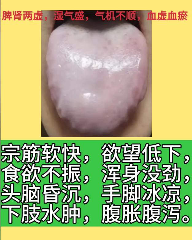 三张舌象对照：不同体质的男士调理思路