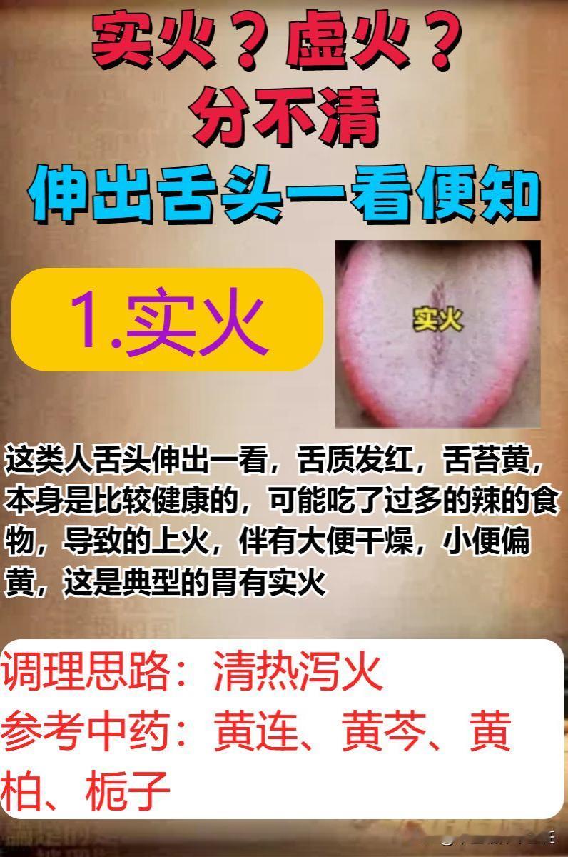 总是分不清自己是实火还是虚火？伸出舌头看看就知道了！