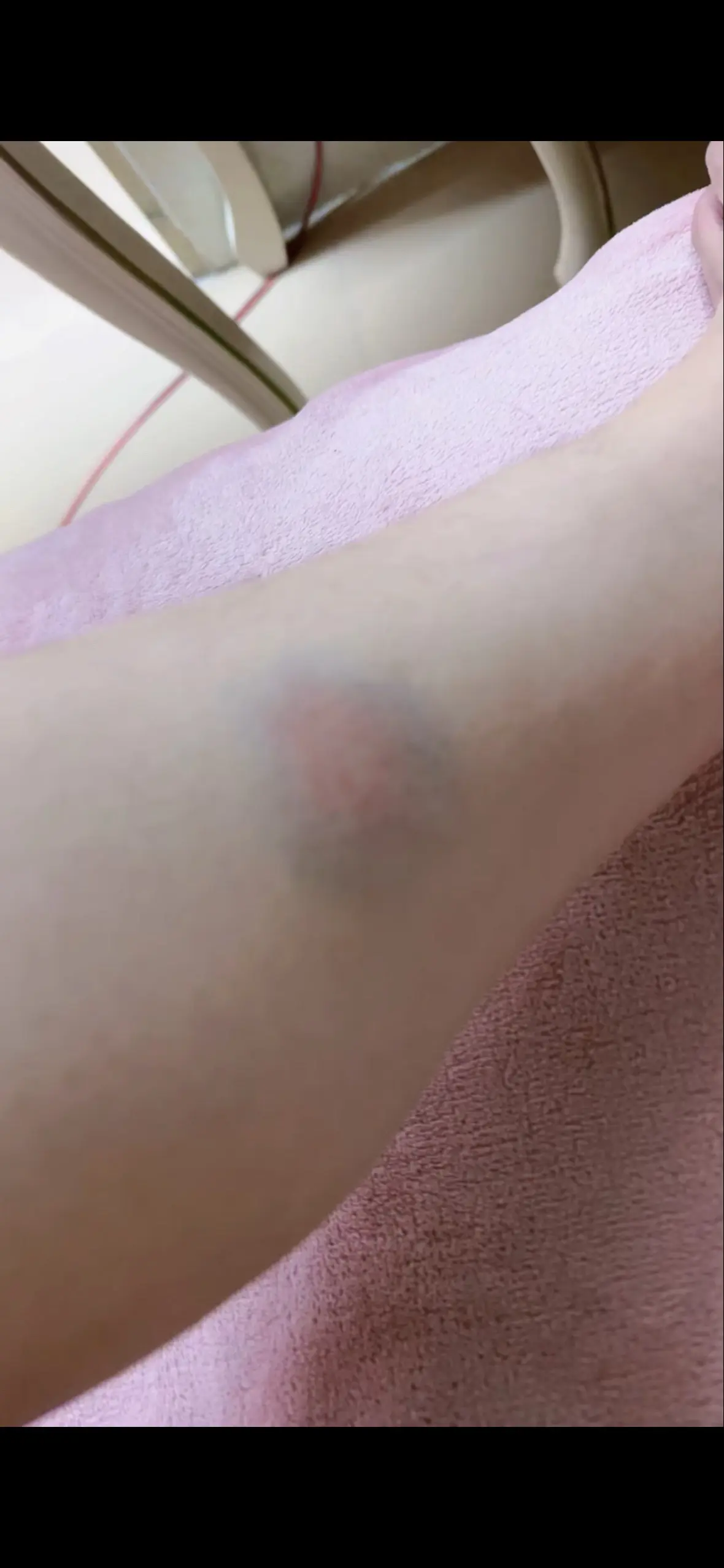 看不到的伤疤最疼