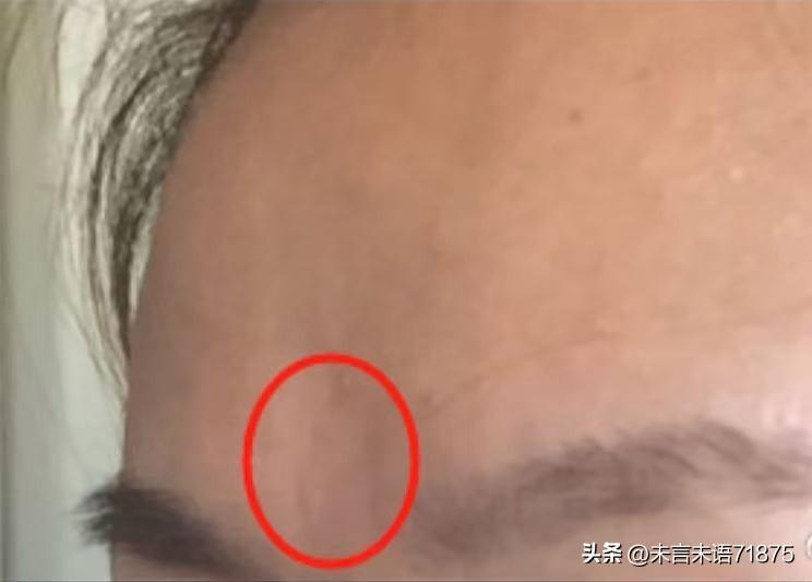 我加了一个群，他说能隔空诊断你有没有病。
我就给他发了一张面部的图，他给我标出来