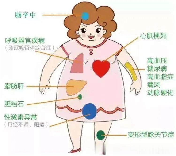 #中国肥胖日#【身上的肥肉从哪里来】#肥胖可能诱发哪些疾病##全民慢病健康科普计