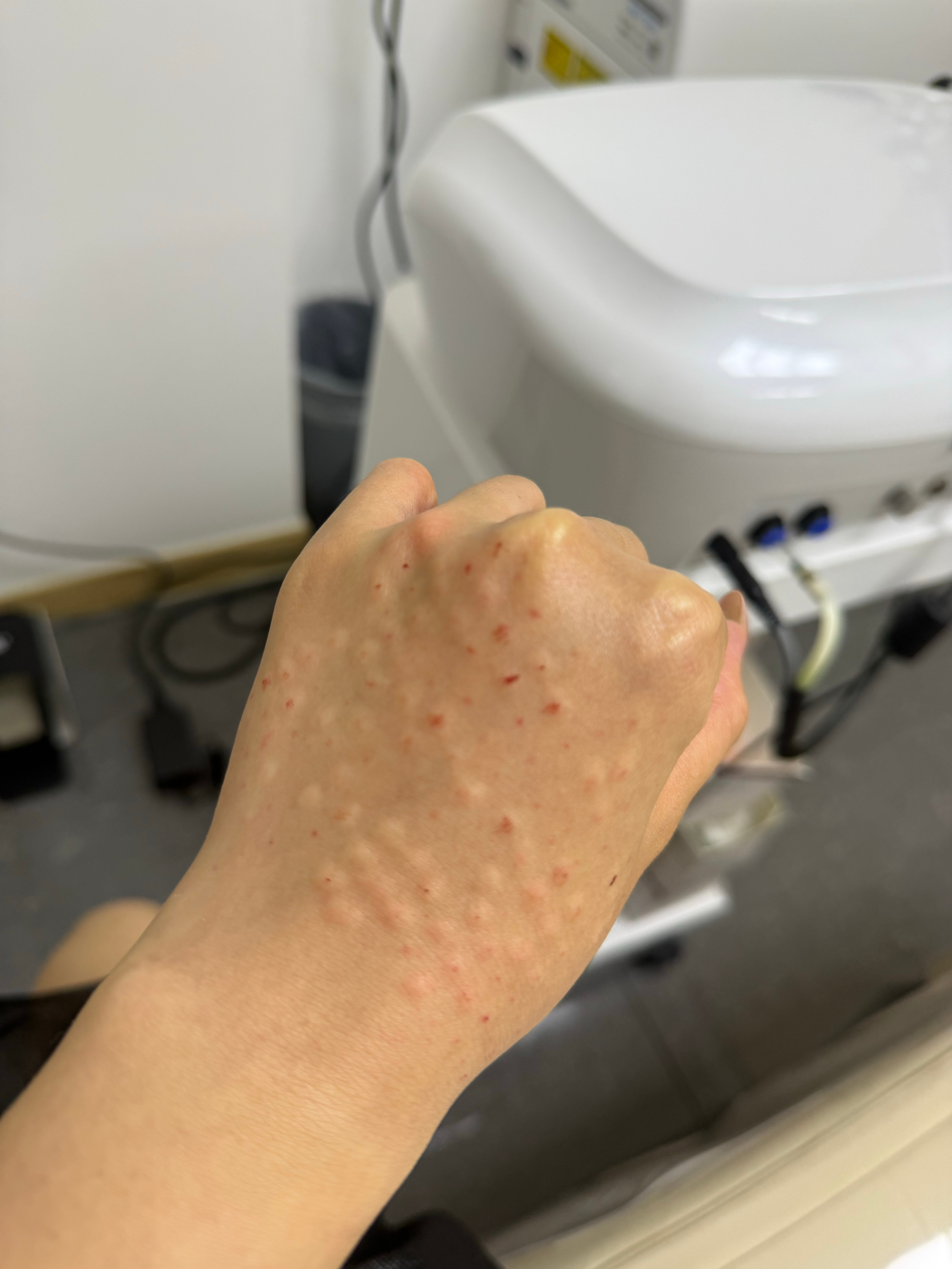 手上怼了两支丽珠兰红盒，其实打过最最惊艳的是瑞德喜！没错，就是手背打的瑞德喜，嫩