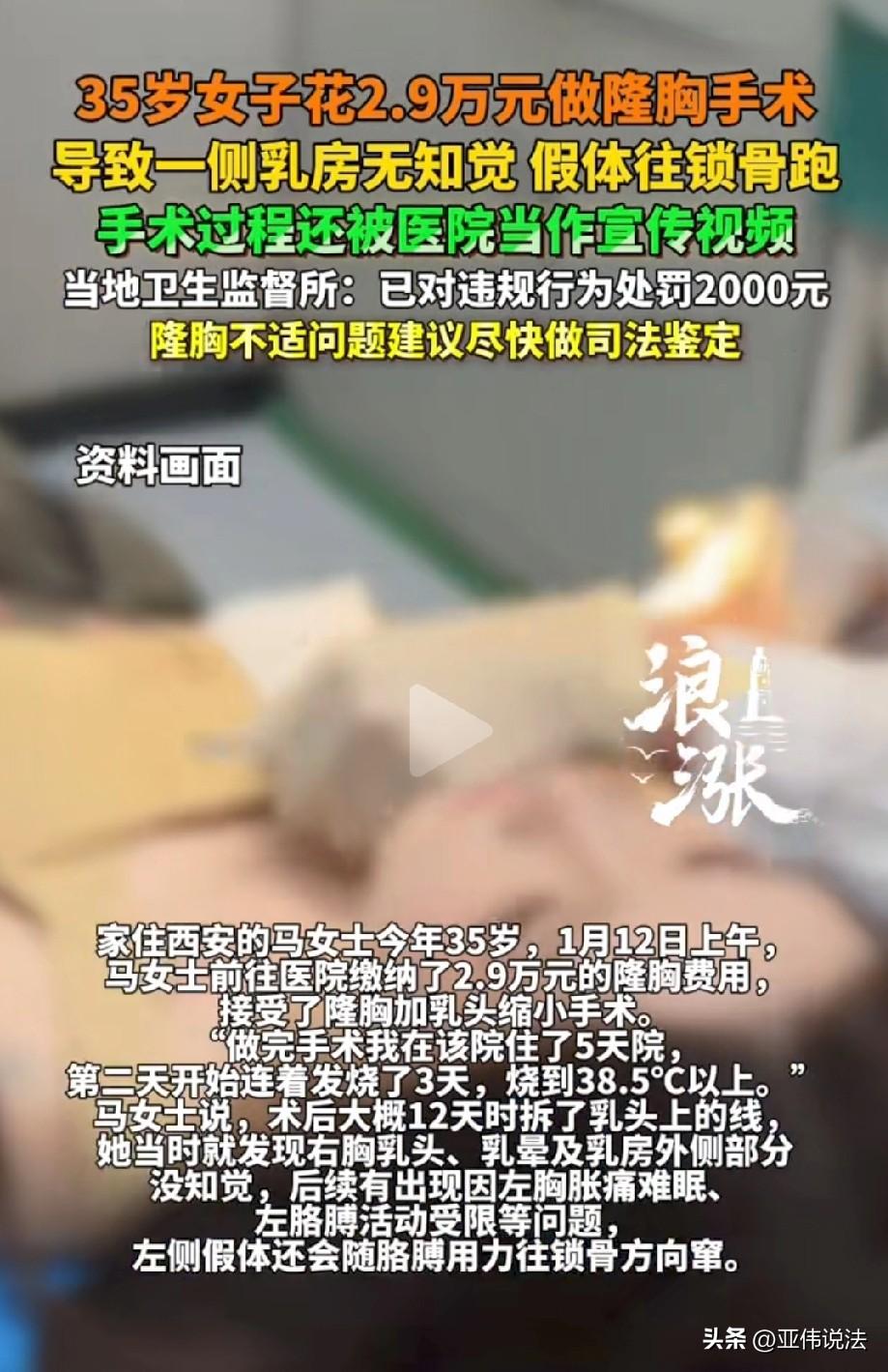 陕西西安，35岁女子为了让自己变得更有魅力，特意花2.9万元去做隆胸和乳头缩小手