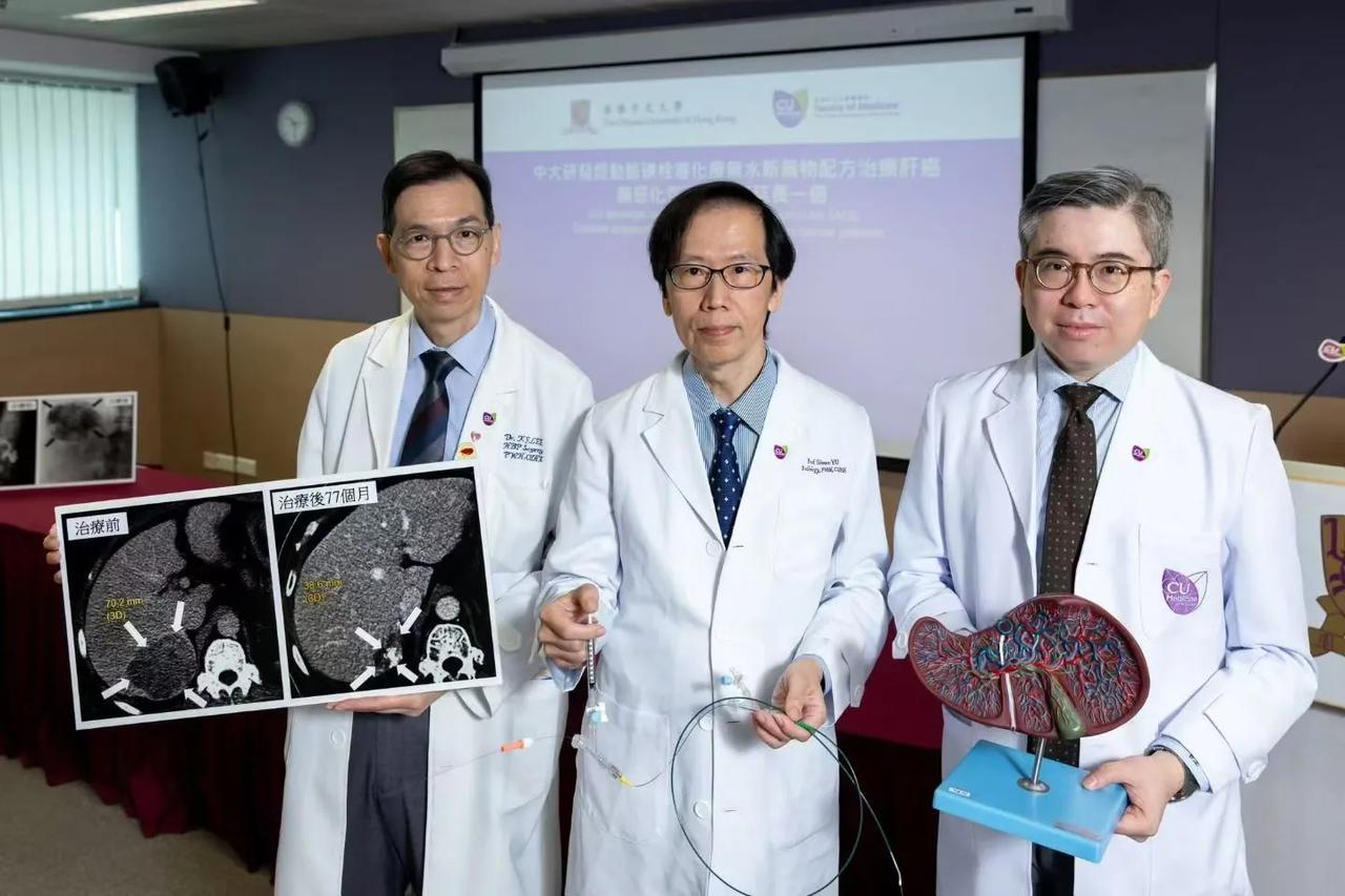 中大医学院最新研发，经动脉碘栓塞无水化疗药物新配方，以无水纯化疗药「顺铂」配合碘