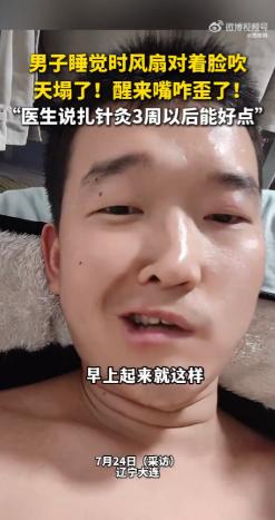 7月25日，辽宁大连，一名男子因为觉得太热，睡觉时用风扇直吹脸，结果一觉醒来发现